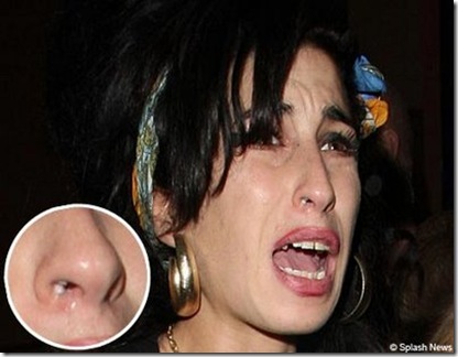 Amy Winehouse
